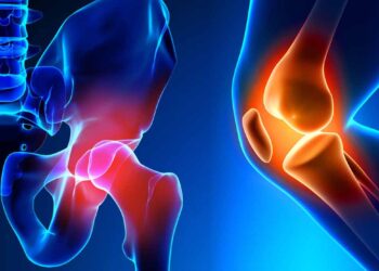 Hip and knee replacement | FintechZoom