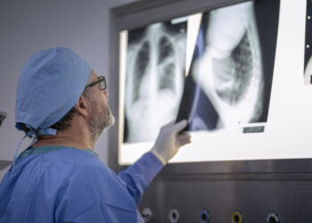 Doctor analyzing chest x-ray on lightbox | FintechZoom