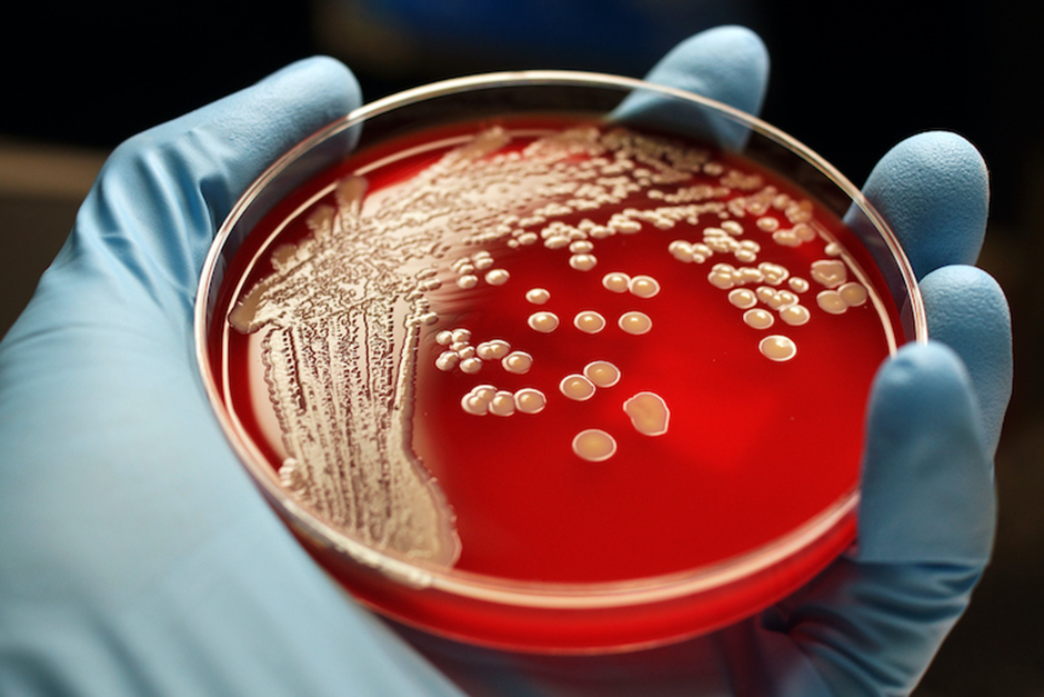 A gloved hand holds a Petri dish with a red agar medium displaying white bacterial colonies of various sizes. The background is dark, highlighting the contrast between the red agar and the white bacterial growth. | FintechZoom