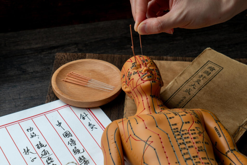 A hand skillfully inserts acupuncture needles into a small model of a human body marked with meridian lines, reflecting traditional Korean techniques. Nearby, acupuncture needles rest on a wooden dish alongside papers adorned with elegant Chinese characters. | FintechZoom